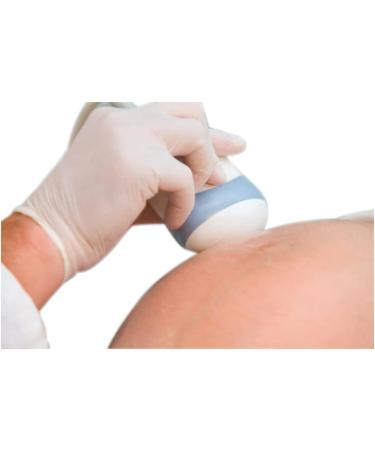 Buy Echoson Ultrasound Gel 250ml Premium Contact Gel for Sonography & Stimulation Fast International Shipping - Buy Online on GoSupps.com