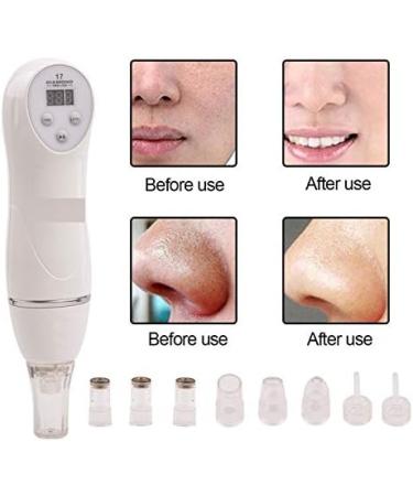YAVOCOS Blackhead Vacuum Suction Remover - Mini Diamond Dermabrasion Skin Peeling Beauty Device - Buy Online on GoSupps.com