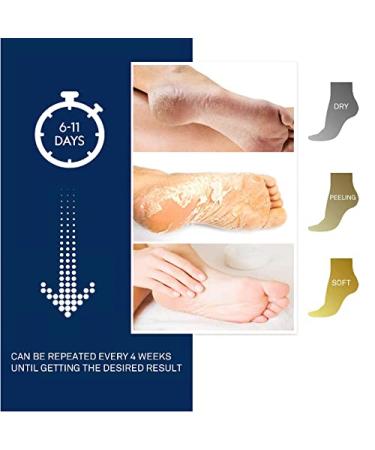 Aliceva One Step Foot Peel Mask - Exfoliating Callus Remover | 2 Pairs - Buy Online on GoSupps.com