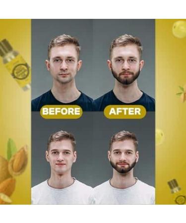 Premium Organic Beard Growth Oil - Nourishing Serum with Natural Ingredients for Boosted Beard Growth | 2 oz - Buy Online on GoSupps.com