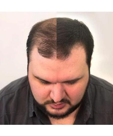 Hair Fibres x2 VOLUMON Keratin Hair Building Fibres for Thinning Hair - Instantly Conceals Thinning Areas for Fuller Thicker Hair - For Men & Women 28g x2 (Medium Brown) - Buy Online on GoSupps.com