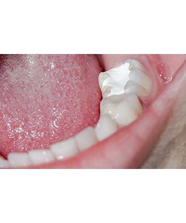 Fermin Temporary Dental Sealant Paste Kit - 40g Emergency DIY Cement for Quick Repairs | International Shipping - Buy Online on GoSupps.com