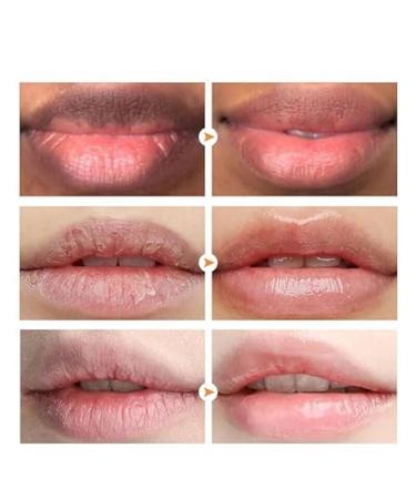 Lip Balm For Remove Dark Lip Melanin Dead Skin Removal Lighten Lip Lines Exfoliate Whitening Moisturizing Nourishing Serum - Buy Online on GoSupps.com