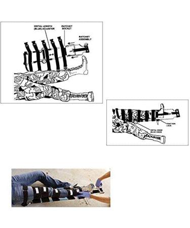 FDSAD Traction Rail - Orthopedic Leg Tensioning Device with Adjustable Ankle Straps & Carrying Bag for Pain Relief | Telescopic Design for Adults - Buy Online on GoSupps.com