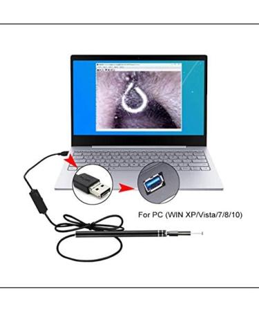 5.5mm Ear Wax Removal Tool Endoscope with 6 LED Light for Windows PC & Android - Otoscope Ear Camera for Ear Cleaning with OTG Function - Buy Online on GoSupps.com