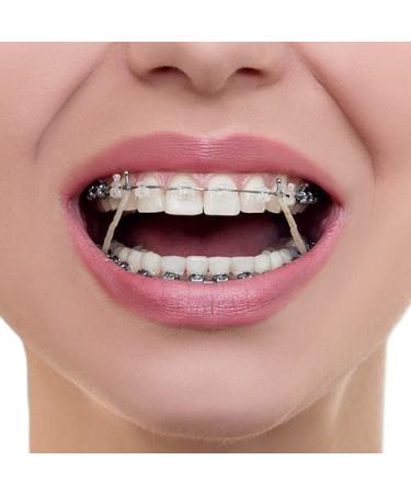 Buy SmileSupplies Colour Elastic - 100 Pcs + Free Placer | International Shipping Available - Buy Online on GoSupps.com