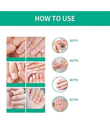 Kerassentials Toenail Treatment Extra Strength - Repair Damaged & Discolored Nails - 3PCS - Buy Online on GoSupps.com