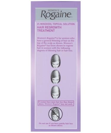 Rogaine for Women Hair Regrowth Treatment - 3 Pack (2 oz each) - Buy Online on GoSupps.com