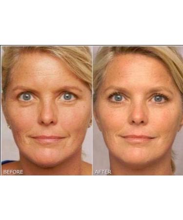 Retinol Gel 0.1 Vitamin A Repairs Fine Lines & Wrinkles Scar Treatment Age and Sun Spots Anti-Aging Formula Gel 20 Grams - Buy Online on GoSupps.com