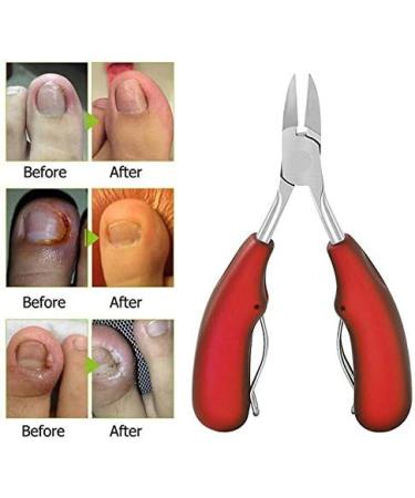 PSGS Toe Nail Clippers Ingrown Toenail Podiatry Correction Nippers Cuticle Cutters Dead Skin Remover Pedicure Foot Care Tool (Color : Black) - Buy Online on GoSupps.com