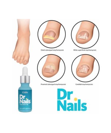 Cabs Nail Care and Foot Cream - Nail Fungus Prevention Lotion Drops - Buy Online on GoSupps.com