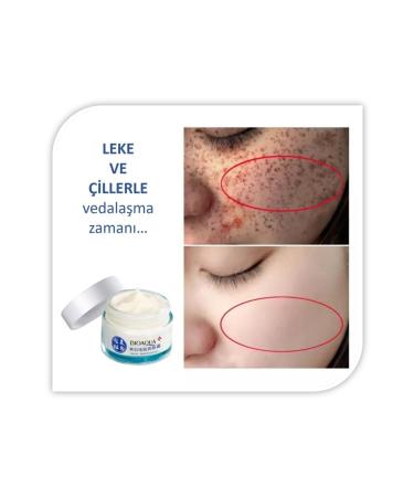 BIOAQUA Anti-Spot and Anti-Freckle White and Bright Appearance Concentrated Niacinamide Cream 50 gr - Buy Online on GoSupps.com