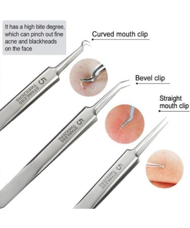 DMSUO No. 5 Blackhead Remover Tweezers Professional Stainless Clips for Beauty Salons High Precision Blackhead Closed Extractor - Buy Online on GoSupps.com
