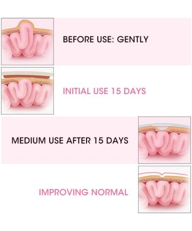 Hernia Belt for Babies - Infant Abdominal Binder 2 Piece Set - Umbilical Hernia Treatment and Support for Newborns - Rosa - Buy Online on GoSupps.com