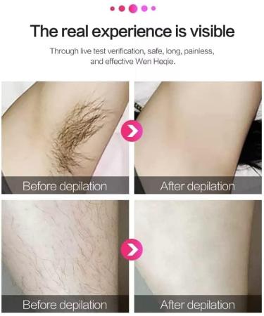 Laser Hair Removal for Women - Permanent Painless IPL Device, Upgraded to 999,999 Flashes, 5 Energy Levels, 2 Modes - Beautify Skin Face Body Bikini - Light Green - Buy Online on GoSupps.com