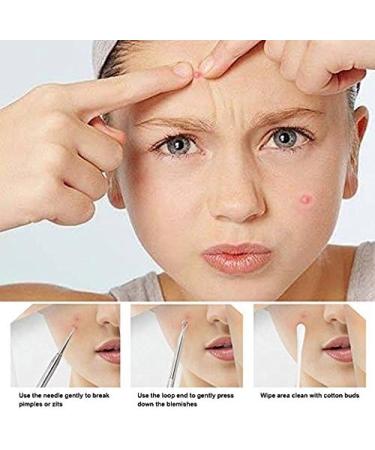 5-in-1 Blackhead Remover Tool Kit - Acne Whitehead & Comedone Extractor Set for Clear Skin - Buy Online on GoSupps.com
