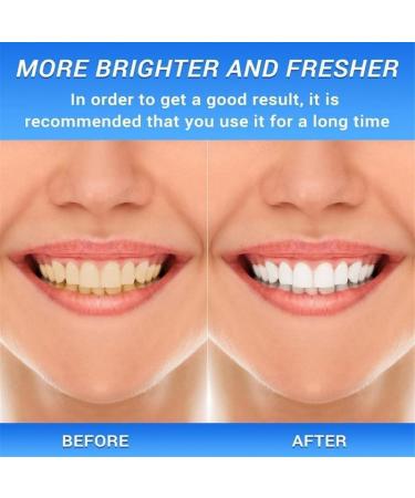 Xoermioy Niacinamide Whitening Toothpaste - Fresh Breath Antiplaque Sensitive Teeth Repair | Buy Online - Global Shipping Available - Buy Online on GoSupps.com