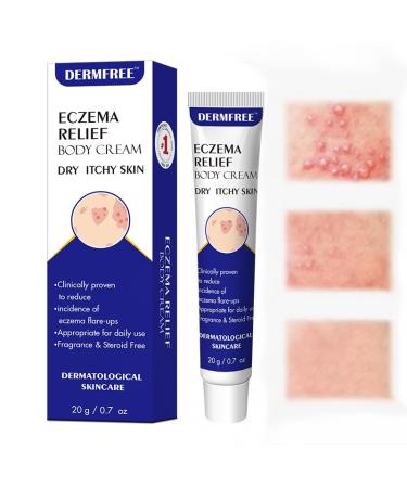 Eczema Care and Anti-itch Cream for Men and Women. Suitable for Dry and Eczema-prone Skin. Suitable for Itchy Skin Wet Itching Urticaria Dermatitis. Unscented and Preservative-free. 20g