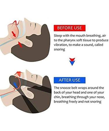 VANVENE Stop Snoring CPAP Chin Strap - Anti-Snore Solution, Adjustable Support Device (Blue) - Buy Online on GoSupps.com