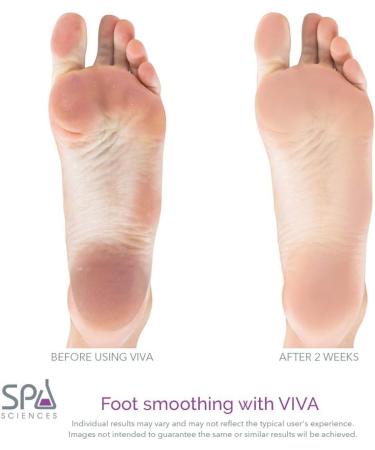 Spa Sciences Viva Professional Electronic Foot Smoothing Pedi Tool - Rechargeable, Powerful Callus Remover for Hard, Dry Skin - Includes 2 Treatment Heads - Buy Online on GoSupps.com