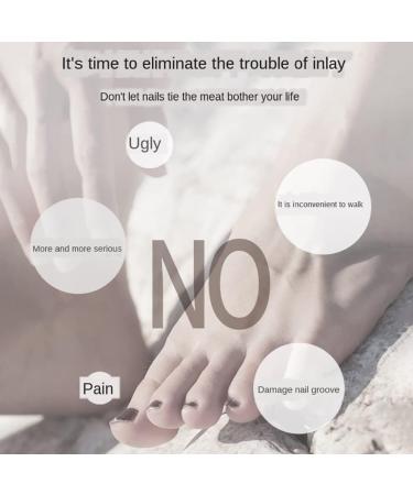 Toe Nail Correction Tool Ingrown Toenail Treatment Tool Painless Inflammation Cure Metal Pedicure Manicure Toe Nail Correction Tool - Buy Online on GoSupps.com