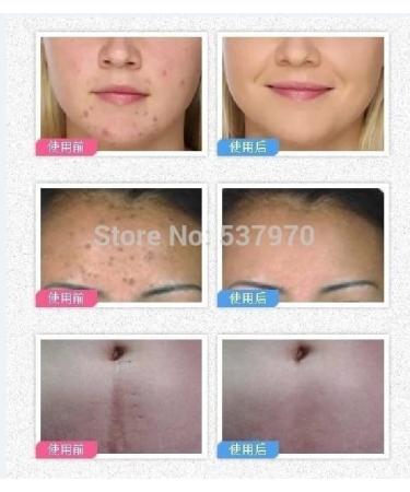 Bepanthen Skin Moisturizer 30g - Hydrating Cream for Dry Skin - Buy Online on GoSupps.com