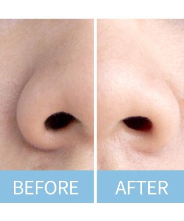 Buy 50 Nasal Wax Applicators & Nose Hair Removal Sticks - Effective Cleaning for Men & Women - International Shipping Available - Buy Online on GoSupps.com