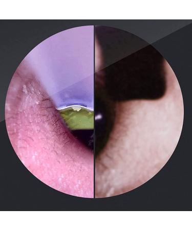 GIENEX Ear Wax Removal Tool with 6 LED Lights - Ear Scope Camera for Adults, Children, Pets - Buy Online on GoSupps.com