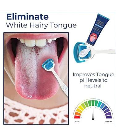 Jiaweiiy White Hair Tongue Cleaning Set - Fresh Breath Gel & Brush | 1 Piece for Optimal Oral Hygiene - Buy Online on GoSupps.com