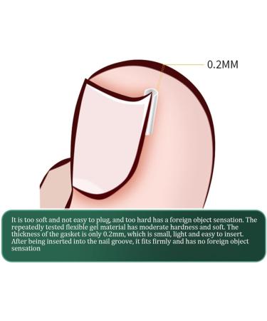 3 Pieces Toenail Straightener Strips Clear Ingrown Toenail Corrector Ingrown Toenail Groove for Women Men Nail Treatment Pedicure Tool - Buy Online on GoSupps.com