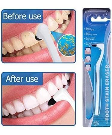 Professional Tartar Remover Set | Teeth Cleaning & Stain Removal | Tooth Polisher for Plaque & Discoloration - Buy Online on GoSupps.com