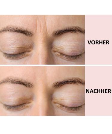 Sandyskin Facial Plaster & Eye Pads | 165 x Face Pads for Wrinkle Reduction | Smooth Facial Folds & Eye Stripes | Free Shipping Worldwide - Buy Online on GoSupps.com