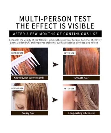 Natural Handmade Shampoo Bar - 100% Organic Ginger Hair Wash for Soft Glossy Hair | Eco-Friendly Set of 2 - Nourish Scalp & Moisturize - Buy Online on GoSupps.com