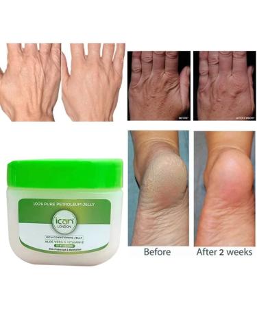 ICAN LONDON ALOE VERA & VITAMIN E 100% PURE PETROLEUM JELLY 368G - Buy Online on GoSupps.com