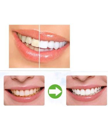 Buy 3x Dabur Herbal Activated Charcoal Toothpaste 100ml - Ayurvedic Oral Care for Whiter Teeth and Fresh Breath - Buy Online on GoSupps.com