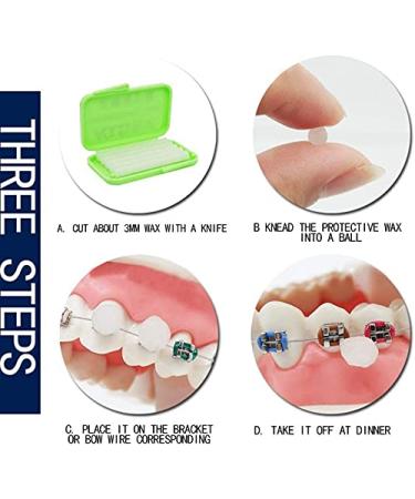 Orthodontics Wax for Brace Wearers | Fruit Flavored Gum Protection (10 Pack) - RZJZGZ Dental Oral Care - Buy Online on GoSupps.com