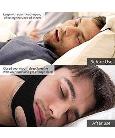 VANVENE Stop Snoring CPAP Chin Strap - Anti-Snore Solution, Adjustable Support Device (Blue) - Buy Online on GoSupps.com