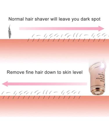 Facial Hair Remover Replacement Head | Gen 1 Single Halo Compatible | Flawless Hair Removal Tool Blades (GEN 1 DEVICE ONLY) - Buy Online on GoSupps.com