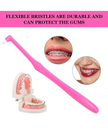 Ververt Touch Dnichs Orthodontic Toothbrush Set - 3-Pack Small Head Tooth Cleaning Brushes - Pink - Ideal for Effective Oral Care - Buy Online on GoSupps.com