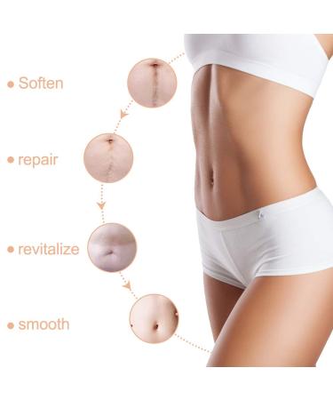 Soothing Silicone Scar Removal Sheets | Flattens & Softens Scars from C-sections, Burns, Stretch Marks & Acne | Effective on New & Old Scars - Buy Online on GoSupps.com