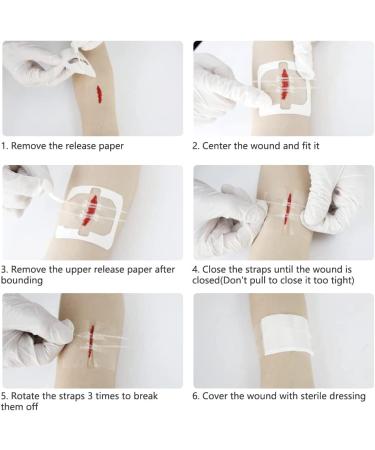 Smerphox Wound Closure Strip - Sterile First Aid Band Kit for Emergency Wound Care - Suture-Free Adhesive Stitch Device - 6pcs - Buy Online on GoSupps.com