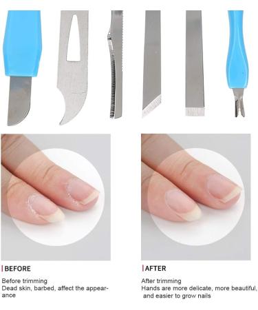 Ultimate Foot Skin Remover & Rustproof Footrest - Soft Smooth Feet Care for Home & Salon Use | Treat Cracked Dry Dead Skin - Buy Online on GoSupps.com