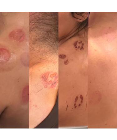 La Parea Wellness Eczema Relief Cream - Buy Online on GoSupps.com