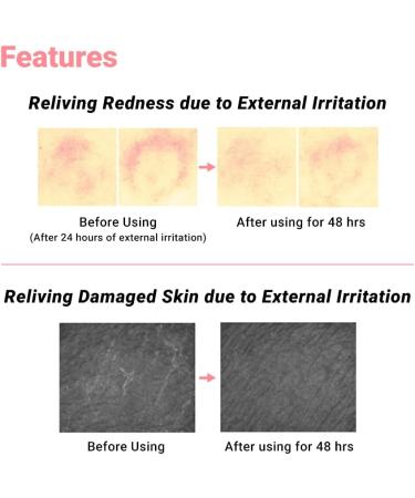 Real Barrier Cicarelief Cream Recovering Face Moisturizer for Damaged Skin Calming with Cica Panthenol Madecassoside Dressing Care Sunburn Relief Irritation Tested 1.05 Oz. 30g - Buy Online on GoSupps.com