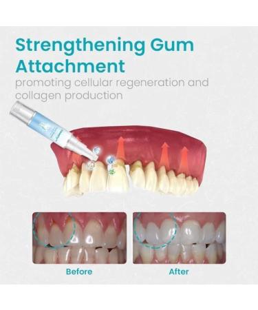 Frosty Neptune Teeth Whitening Essence - Fast & Effective Tooth Stain Removal (5 PCs) - Brighten Your Smile Internationally - Buy Online on GoSupps.com