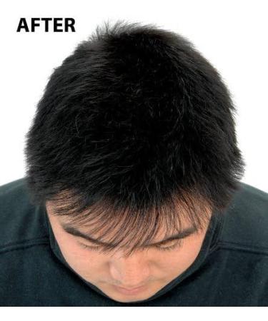Super Million Hair 1 x 25g Hair Building Fibers Auburn No. 8 - Buy Online on GoSupps.com
