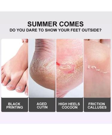 Masque exfoliant pour les pieds hydratant et blanchissant nourrit les peaux s ches et limine les callosit s. 2pcs - Buy Online on GoSupps.com