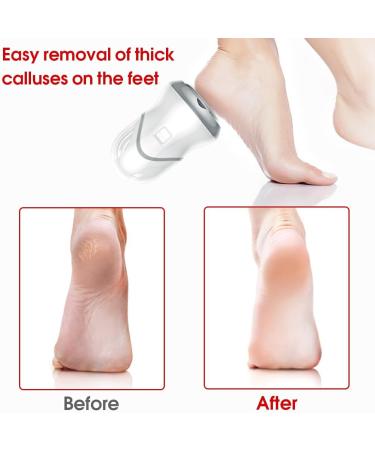 dijiusidy Hand Held Electronic Foot Callus Dead Skin Remover Professional Heel Grinding Adjustable Feet File Pedicure Accessories - Buy Online on GoSupps.com
