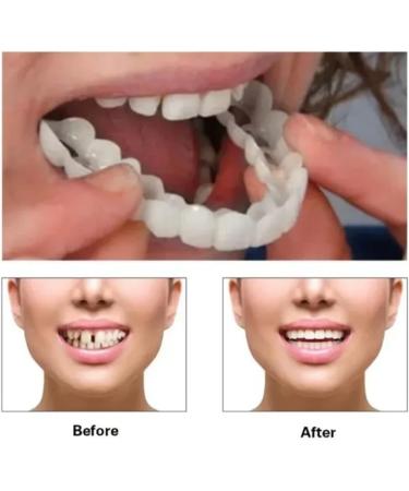 Iksvmsi Protheses Fake Teeth - 2 Pairs of Temporary False Teeth Veneers for Tooth Defects | International Shipping - Buy Online on GoSupps.com