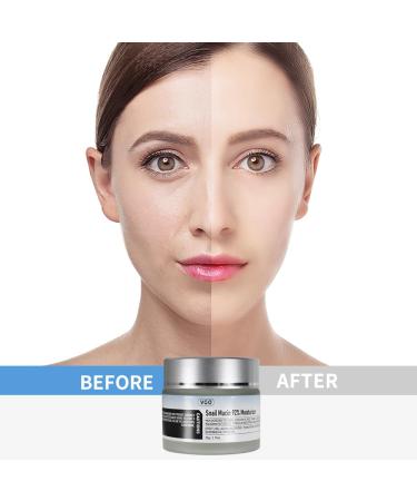 VGO Snail Mucin 92% Moisturizer - Hydrating Face Gel Cream for Dry & Sensitive Skin - 50g - All Skin Types - Buy Online on GoSupps.com
